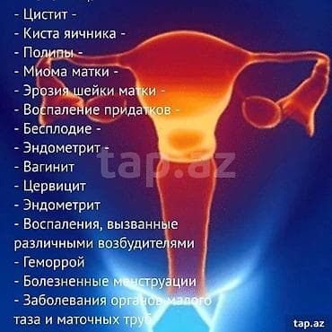 Tampon Fohow - Terkibinde 40 növ ot var - soyuqlamanı kesir -epidermis — 2
