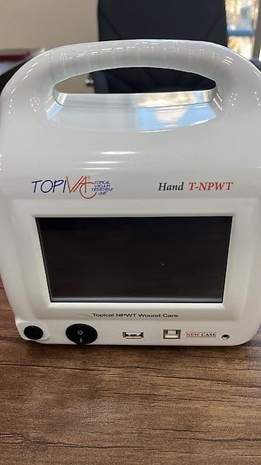 limfa drenaj aparati: Məhsul: TOPIVA Hand T‑NPWT – Topikal Mənfi Təzyiqli Yara Terapiyası — 1