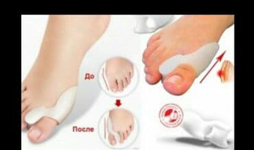 padaqra ucun silikon: Padaqranı mualice eden ve agrinin qarşisini alan fiksator. Silikon — 3