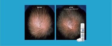 королевский боб для похудения 36 капсул: Маска для волос, Для всех типов волос, Новый, Бесплатная доставка, Платная доставка, Доставка в районы — 13