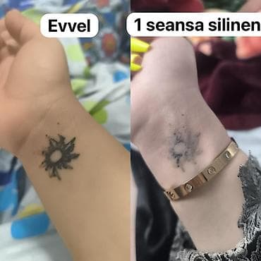 Tatunuzun seklin gonderin qiymet deyilsin🤗3 seansa kimi lyuboy seansda