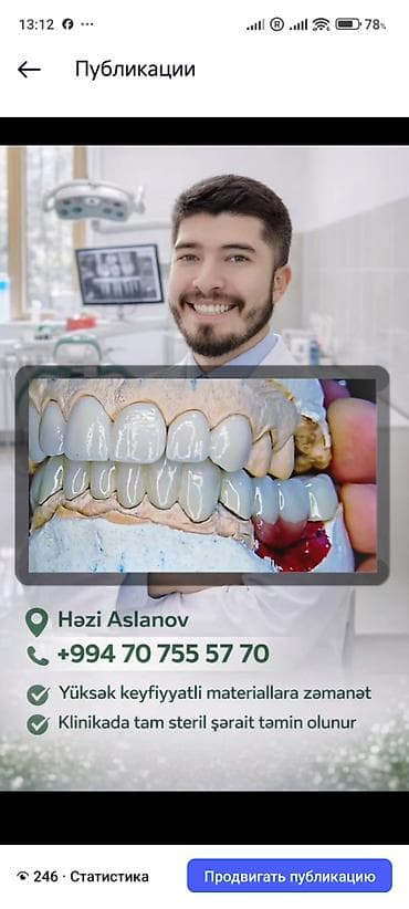 avtomobil yuma: İndi Daha Rahat və Estetik 💠 Qiymətlər Estetik plomb (1 diş) – 50₼ — 7