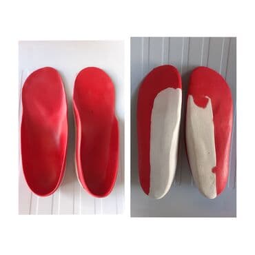 Endirim olundu‼️Ortopedik supinator. Xususi sifariwle 120 man lalafo.az -da Endirim olundu‼️Ortopedik supinator. Xususi sifariwle 120 man