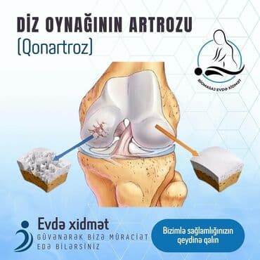masaj xidməti 2021: Müalicəvi masaj, Uşaqlar üçün, Evə gəlməklə, Klinikada — 12