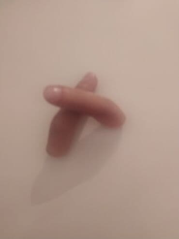 oksigen balonu icin reduktor: Turkiyenin "REHA The Art of Prosthetics" klinikasinda duzeldilib, Sol — 3