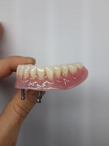 Permanent makiyajı: Her növ total protezlərin hazırlanması bir başa paciente — 9