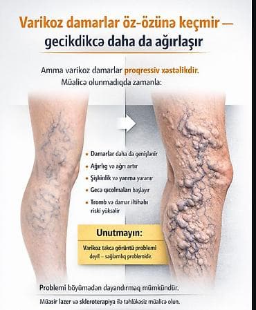 devalt lazer: Varikoz müalicəsi, Klinikada — 2
