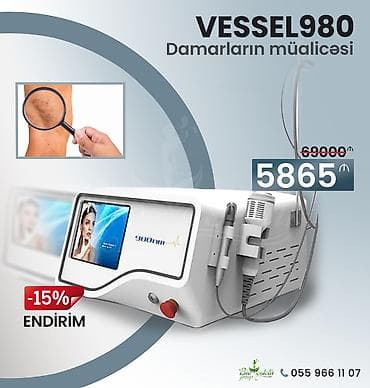 Lazer terapiya aparatı - Damarların müalicəsi - Qerpesin müalicəsi -