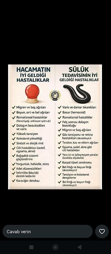 bedende lekeler: Rahatladıcı hicama, sülük terapiyası və peşəkar masaj xidməti — 2