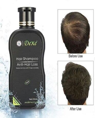 selenium sulfide 2.5 shampoo iran: Saç şampunu, Hər növ saçlar üçün, Yeni, Pulsuz çatdırılma — 3