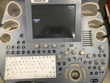 usm aparati: Voluson USM Voluson USM aparatı Yeni və ikinci hər növ USM — 3