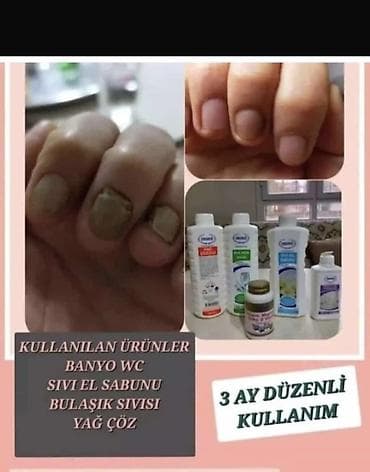 androlife tabletka ne ucundur: ERSAĞ məhsul və əlavələri – gündəlik qulluq və qida dəstəyi 1) Ersağ — 3