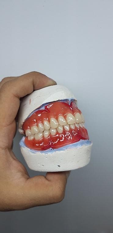 2020 dirnaq bezekleri: Her növ total protezlərin hazırlanması bir başa paciente — 8