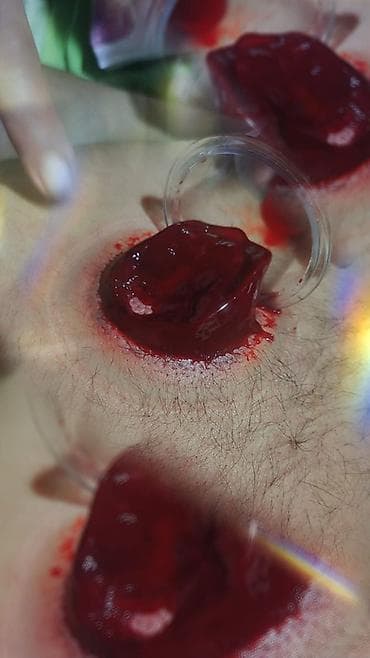 💆‍♂️ Masaj Xidməti 💆‍♀️ ✔ Relax masaj ✔ Sport masaj ✔ Klassik masaj ✔