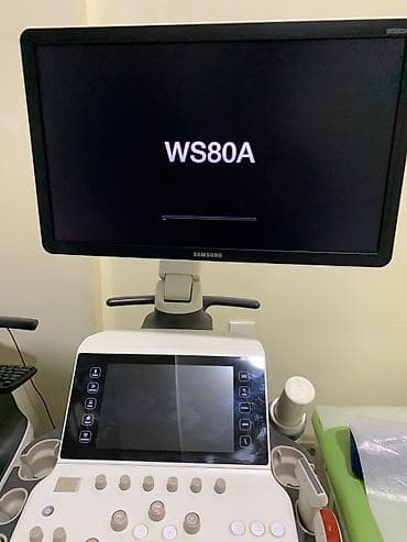 2019 Samsung WS80A ultrasəs diaqnostika sistemi - Təyinat: qadın — 2