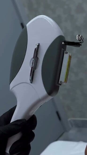 Epilyasiya üçün, Buz lazer