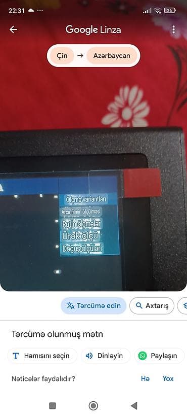 Tibbi avadanlıq: Rəqəmsal ultrasəs/USG görüntüləmə cihazı üçün portativ monitor və — 2