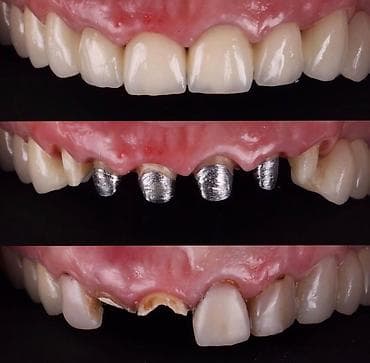 Paltar tikişi: Salam hörmətli və dəyərli Diş Həkimlərimiz.mən diş Texnikiyem.Bakının — 3