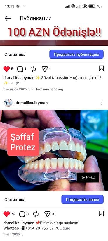 avtomobil yuma: İndi Daha Rahat və Estetik 💠 Qiymətlər Estetik plomb (1 diş) – 50₼ — 4