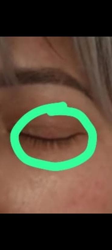 retinal krem qiymeti: Rusiyadan gelib.bedende olan ziyilleri. et xallari qurudub yox — 1
