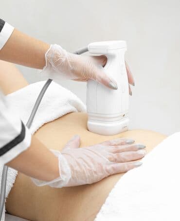 səs yazma cihazı: Liposoniks Bədənin formalaşması üçün yüksək intensivliyə yönəldilmiş — 3