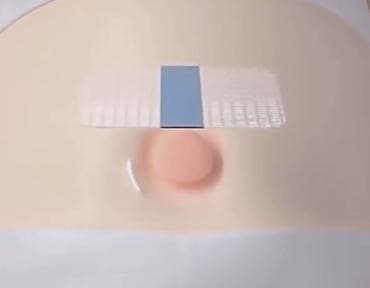 nipel: Uşaq üçün göbək yırtığına qarşı yapışqan plastır dəsti Məhsul: Baby — 9