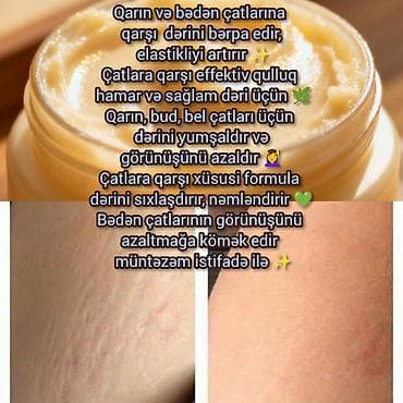 don sekilleri: Bu kremler netice superdi butun sekiller heqiqidi ve kasmetoloq — 2