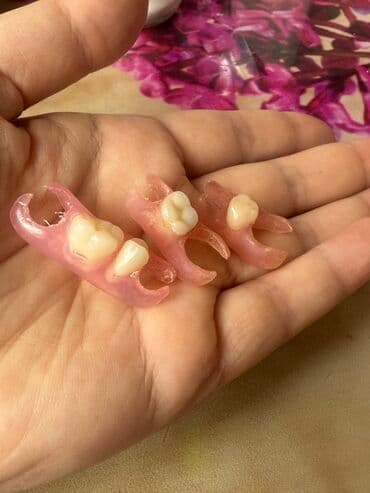 утягивающее белье для полных женщин: Məhsul: Fleks protez tipli hissəvi dişlər (1–2 dişlik sekmentlər).uvuz — 1