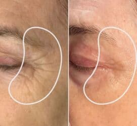 qarin eritmek ucun krem: Estetik–plastik cərrahiyyə və bədən formalaşdırma xidmətləri Təklif — 6