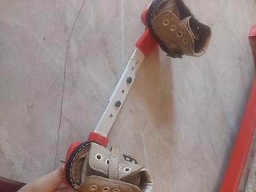 qolu kesilen uşaq: Uşaq üçün ortopedik ayaqqabı və abdüksiya şinası dəsti. Qeyd:ən kiçik — 3