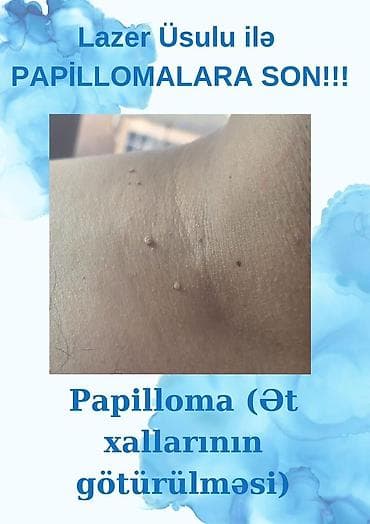 lazer: Tibbi xidmətlər paketi 1) Kişi Check-up – cəmi 49 AZN - Androloqun — 7