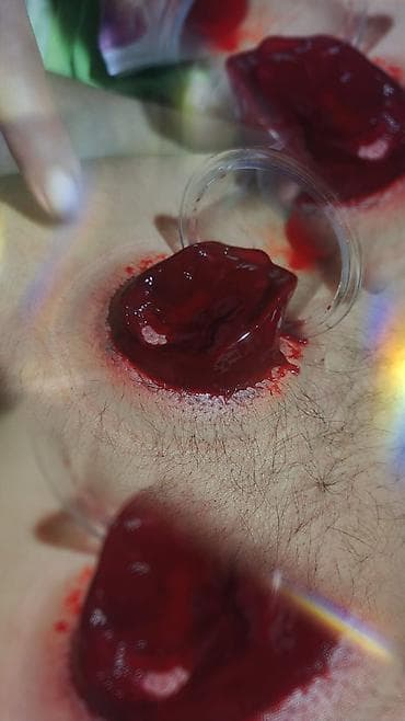 Müalicəvi masaj, Uşaqlar üçün, Kişilər üçün, Qadınlar üçün, Evə gəlməklə lalafo.az -da Müalicəvi masaj, Uşaqlar üçün, Kişilər üçün, Qadınlar üçün, Evə gəlməklə