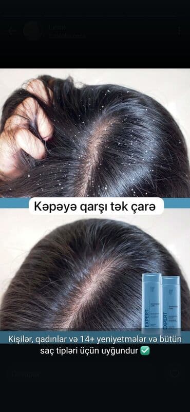 en yaxsi optik linzalar: Faberlik Mehsullarinin Satışı.Keyfiyyetli ve Münasib Qiymet.Hem Alış — 18