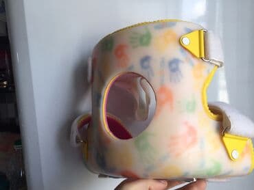 Tibbi avadanlıq: Bud chanaq displaziyasinda shina . Ushaq uchun ortopedik shina 50 man — 3