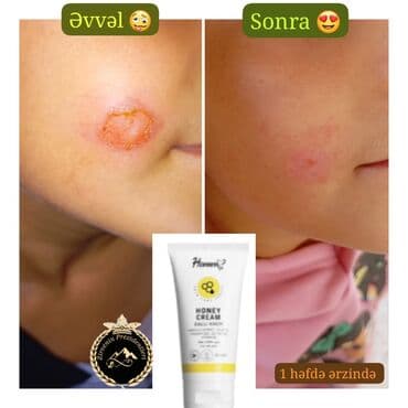 itburnu behmezi faydalari: Məhsul: Honni? Honey Cream – Ballı Krem Təsvir: - Dərinin həssas — 1