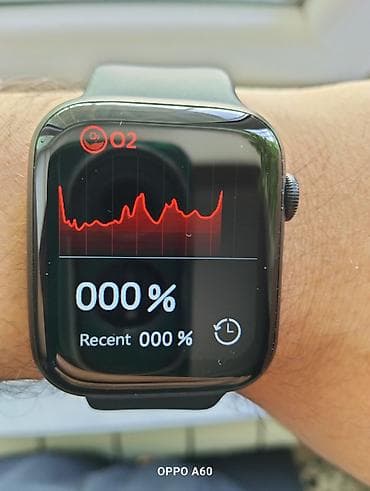 smat: Smart saat, Smart, Sensor ekran, rəng - Qara — 7