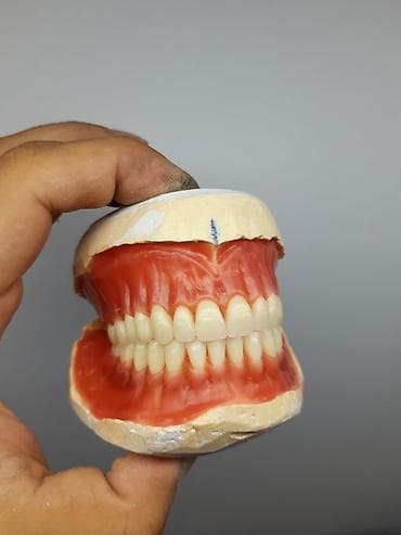 Permanent makiyajı: Her növ total protezlərin hazırlanması bir başa paciente — 8