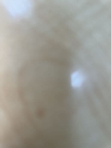 уход за больными на дому: 15 il is staji olan tibb bacisi ucun gece novbesine daye isi — 1