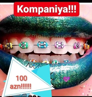 акция на установку брекетов: Stomatologiya — 1