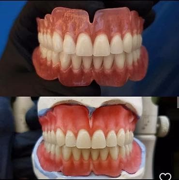 2020 dirnaq bezekleri: Her növ total protezlərin hazırlanması bir başa paciente — 5