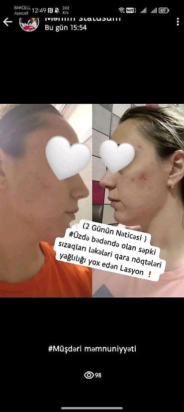 FM serum – dəri baxımı üçün konsentrat serum Xüsusiyyətlər: - Üz — 2