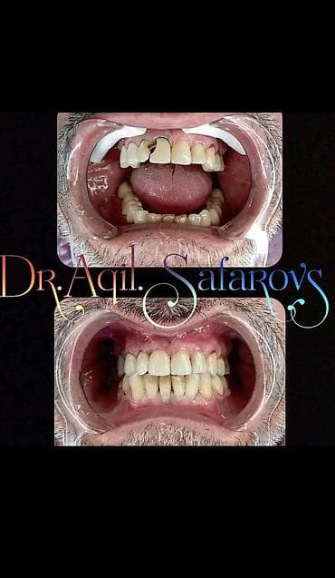 Автоуслуги: Stomatolojı Klinika Dentalux– təbii görünüşlü, parlaq gülümsəmə - — 10