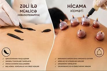 Хиджама, пиявки: Hicamanın əsas faydaları ✔ Qan dövranını gücləndirir – bədəndəki — 1