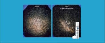 королевский боб для похудения 36 капсул: Маска для волос, Для всех типов волос, Новый, Бесплатная доставка, Платная доставка, Доставка в районы — 14