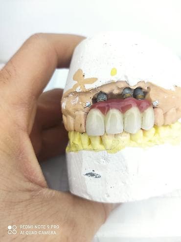 Услуги: Diş texnikliyi kursları(6 ay erzinde tam öyredilir, stomotoloji — 3