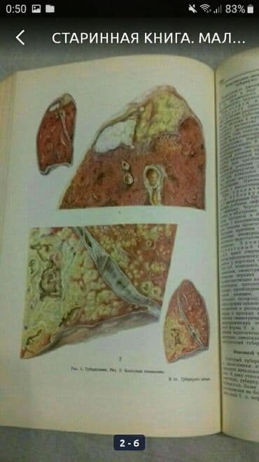 большая медицинская энциклопедия: Старинная книга 
малая медицинская энциклопедия 
1968г. Том 10 — 1