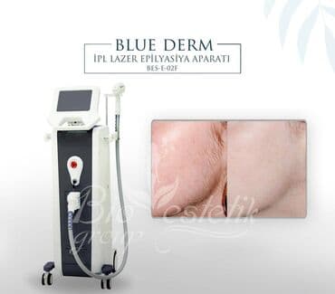 lazer aparatı satılır: Lazer Epilyasiya aparati,IPL Lazer Estetik aparatlar, Ariqlama — 1