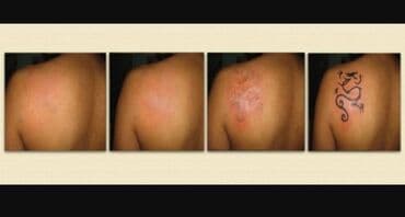 qaş formaları 2022: Salam.Qas Permanent,Microblading,Tatu yazilmasi ve silinmesi,Sac — 3