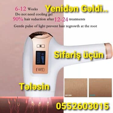 epilator aparati: Lazer epilyatoru, Yeni, Pulsuz çatdırılma — 1