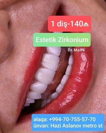 Ünvan: Həzi Aslanov Plobm orta keyfiyyət 30₼ Plobm yüksek keyfiyyət